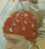 brain