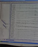brain waves
