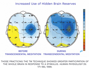 brain